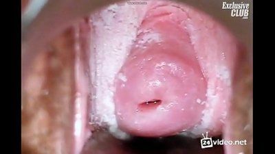 Gynecological fanadihadiana ny vehivavy tsara tarehy